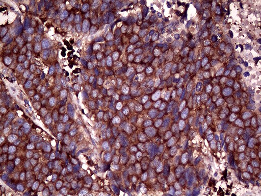 RPL10A Antibody (OTI4B2) Immunohistochemistry;RPL10A Antibody (OTI4B2)[NBP3-44968]-