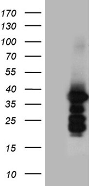 ZCCHC17 Antibody (OTI7F9) Western Blot;ZCCHC17 Antibody (OTI7F9)[NBP3-44974]-
