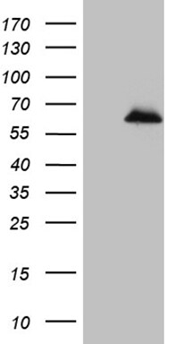 ZNF329 Antibody (OTI5E5) Western Blot;ZNF329 Antibody (OTI5E5)[NBP3-44977]-