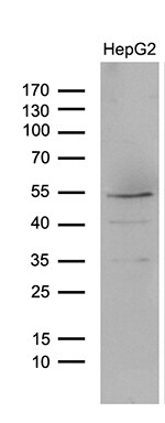 Lhx4 Antibody (OTI4E11) Western Blot;Lhx4 Antibody (OTI4E11)[NBP3-44978]-