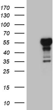 Lhx4 Antibody (OTI1C7) Western Blot;Lhx4 Antibody (OTI1C7)[NBP3-44979]-