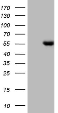 Lhx4 Antibody (OTI6H3) Western Blot;Lhx4 Antibody (OTI6H3)[NBP3-44980]-