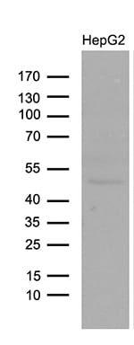 Lhx4 Antibody (OTI6H3) Western Blot;Lhx4 Antibody (OTI6H3)[NBP3-44980]-