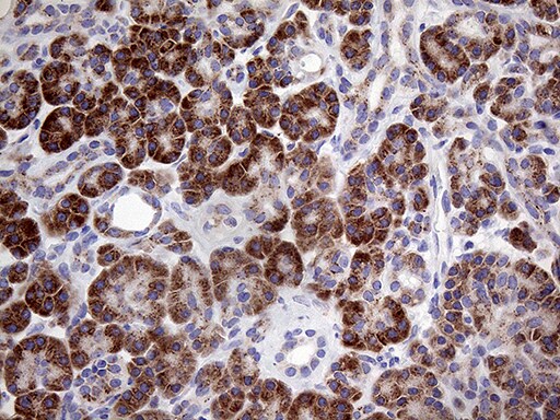 Myotilin Antibody (OTI5E11) Immunohistochemistry;Myotilin Antibody (OTI5E11)[NBP3-44982]-