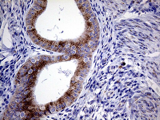 Myotilin Antibody (OTI5E11) Immunohistochemistry;Myotilin Antibody (OTI5E11)[NBP3-44982]-