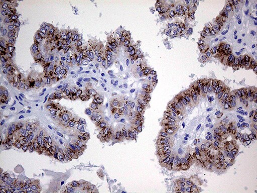 Myotilin Antibody (OTI5E11) Immunohistochemistry;Myotilin Antibody (OTI5E11)[NBP3-44982]-