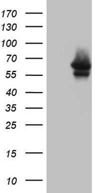Myotilin Antibody (OTI5E11) Western Blot;Myotilin Antibody (OTI5E11)[NBP3-44982]-