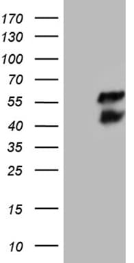 BCL7B Antibody (OTI7H1) Western Blot;BCL7B Antibody (OTI7H1)[NBP3-44983]-