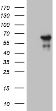 ZNF329 Antibody (OTI7F2) Western Blot;ZNF329 Antibody (OTI7F2)[NBP3-44987]-