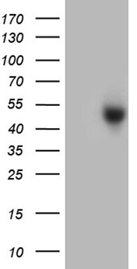 ZCWPW2 Antibody (OTI10A12) Western Blot;ZCWPW2 Antibody (OTI10A12)[NBP3-44988]-