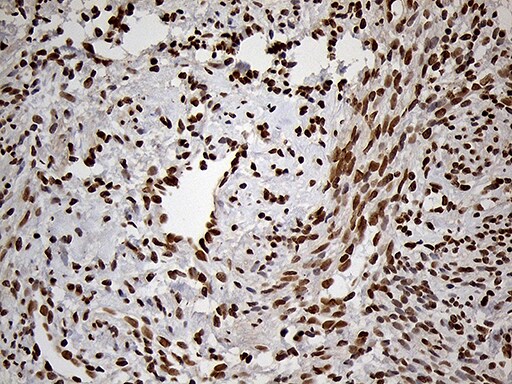 MEIS1 Antibody (OTI3G8)