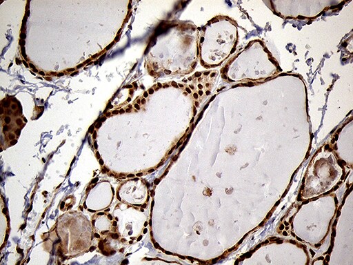 MEIS1 Antibody (OTI3G8) Immunohistochemistry;MEIS1 Antibody (OTI3G8)[NBP3-44990]-