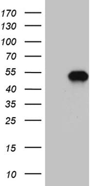 MEIS1 Antibody (OTI3G8) Western Blot;MEIS1 Antibody (OTI3G8)[NBP3-44990]-