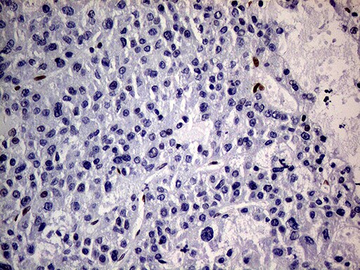 MEIS1 Antibody (OTI2A3) Immunohistochemistry;MEIS1 Antibody (OTI2A3)[NBP3-44991]-