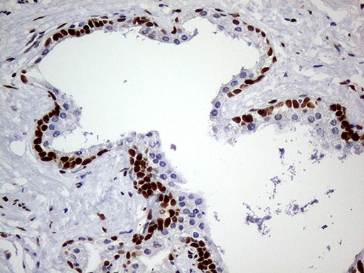 MEIS1 Antibody (OTI2A3) Immunohistochemistry;MEIS1 Antibody (OTI2A3)[NBP3-44991]-