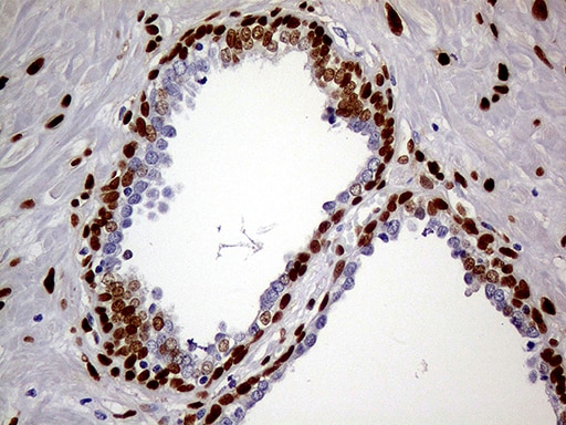 MEIS1 Antibody (OTI2A3) Immunohistochemistry;MEIS1 Antibody (OTI2A3)[NBP3-44991]-