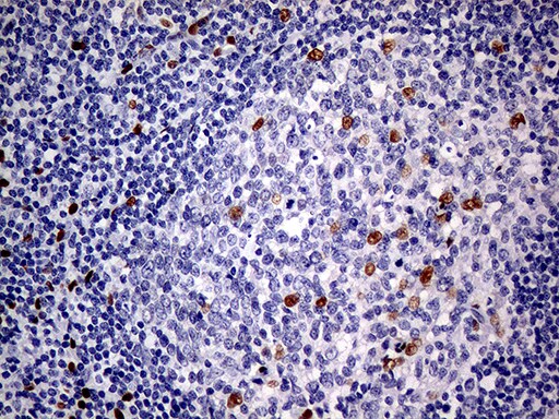 MEIS1 Antibody (OTI2A3) Immunohistochemistry;MEIS1 Antibody (OTI2A3)[NBP3-44991]-