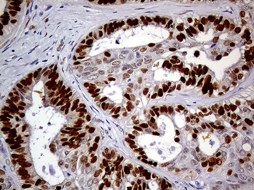 MEIS1 Antibody (OTI2A3) Immunohistochemistry;MEIS1 Antibody (OTI2A3)[NBP3-44991]-