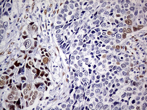 MEIS1 Antibody (OTI2A3) Immunohistochemistry;MEIS1 Antibody (OTI2A3)[NBP3-44991]-