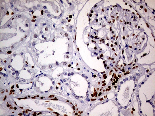MEIS1 Antibody (OTI2A3) Immunohistochemistry;MEIS1 Antibody (OTI2A3)[NBP3-44991]-