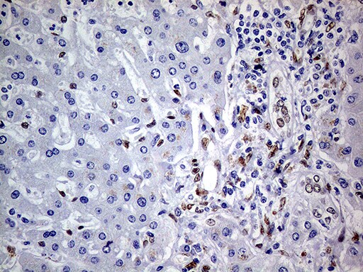 MEIS1 Antibody (OTI2A3) Immunohistochemistry;MEIS1 Antibody (OTI2A3)[NBP3-44991]-