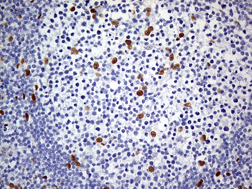 MEIS1 Antibody (OTI2A3) Immunohistochemistry;MEIS1 Antibody (OTI2A3)[NBP3-44991]-
