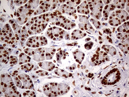 MEIS1 Antibody (OTI2A3) Immunohistochemistry;MEIS1 Antibody (OTI2A3)[NBP3-44991]-