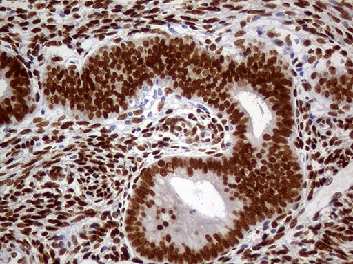 MEIS1 Antibody (OTI2A3) Immunohistochemistry;MEIS1 Antibody (OTI2A3)[NBP3-44991]-