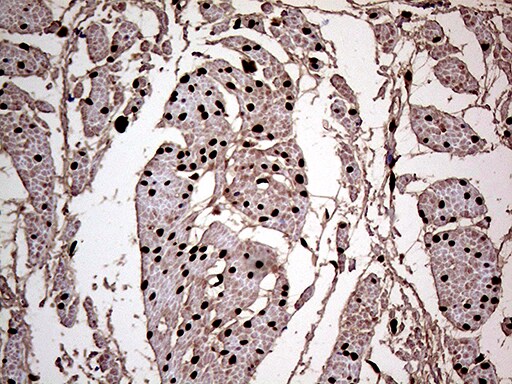 MEIS1 Antibody (OTI1B4)