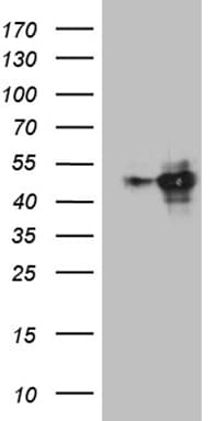 MEIS1 Antibody (OTI1B4) Western Blot;MEIS1 Antibody (OTI1B4)[NBP3-44993]-