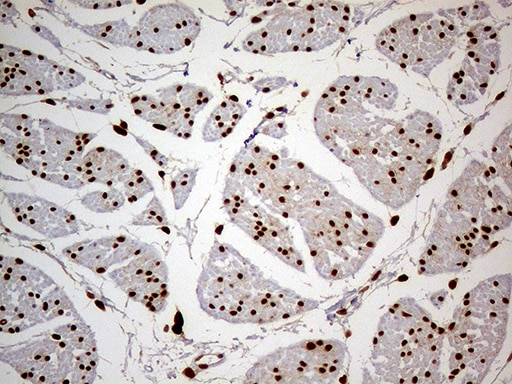 MEIS1 Antibody (OTI3H2)