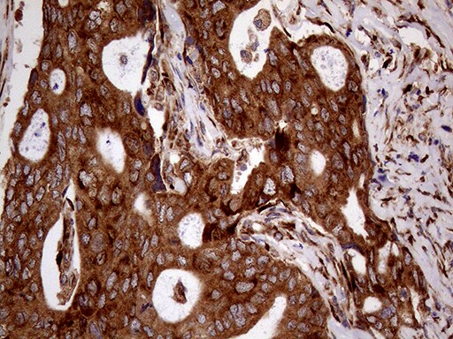 RRBP1 Antibody (OTI3F1) Immunohistochemistry;RRBP1 Antibody (OTI3F1)[NBP3-44996]-