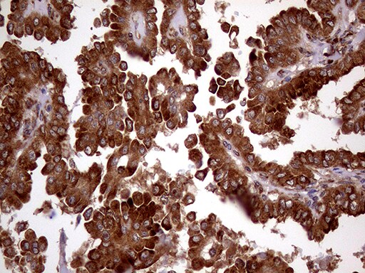 RRBP1 Antibody (OTI3F1) Immunohistochemistry;RRBP1 Antibody (OTI3F1)[NBP3-44996]-