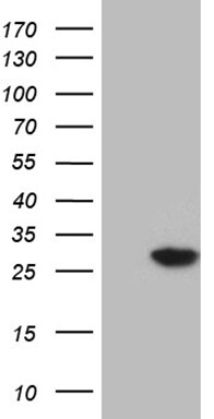 NUDT4 Antibody (OTI1C2) Western Blot;NUDT4 Antibody (OTI1C2)[NBP3-45005]-