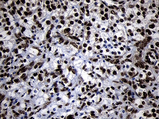 HOXC4 Antibody (OTI1F6)