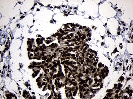 HOXC4 Antibody (OTI1F6) Immunohistochemistry;HOXC4 Antibody (OTI1F6)[NBP3-45006]-