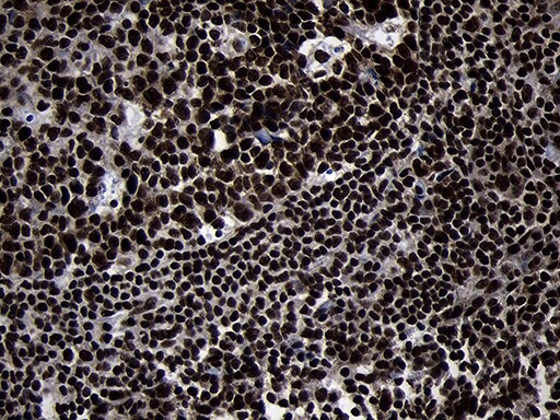 HOXC4 Antibody (OTI1F6) Immunohistochemistry;HOXC4 Antibody (OTI1F6)[NBP3-45006]-