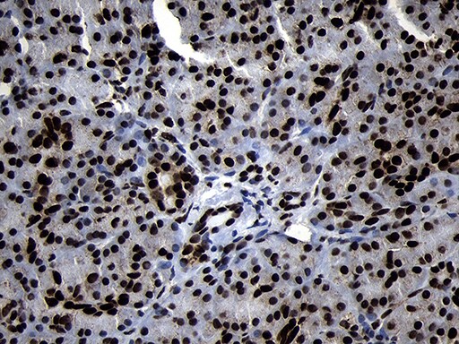 HOXC4 Antibody (OTI1F6) Immunohistochemistry;HOXC4 Antibody (OTI1F6)[NBP3-45006]-