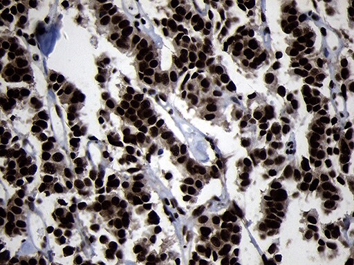 HOXC4 Antibody (OTI1F6) Immunohistochemistry;HOXC4 Antibody (OTI1F6)[NBP3-45006]-