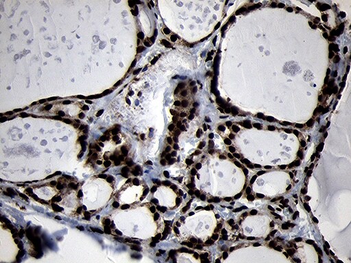 HOXC4 Antibody (OTI1F6) Immunohistochemistry;HOXC4 Antibody (OTI1F6)[NBP3-45006]-
