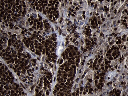 HOXC4 Antibody (OTI1F6) Immunohistochemistry;HOXC4 Antibody (OTI1F6)[NBP3-45006]-