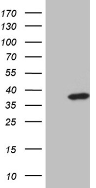ZMAT4 Antibody (OTI9E11)