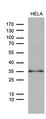 ZMAT4 Antibody (OTI9E11)