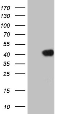HOXC4 Antibody (OTI6B11) Western Blot;HOXC4 Antibody (OTI6B11)[NBP3-45008]-