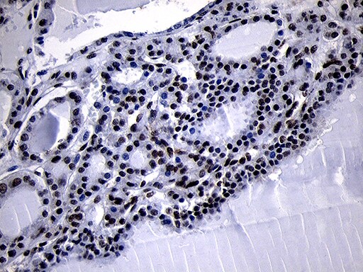 HOXC4 Antibody (OTI2D5) Immunohistochemistry;HOXC4 Antibody (OTI2D5)[NBP3-45009]-