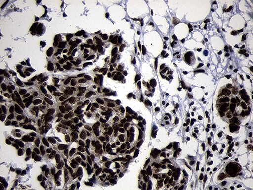 HOXC4 Antibody (OTI2D5) Immunohistochemistry;HOXC4 Antibody (OTI2D5)[NBP3-45009]-
