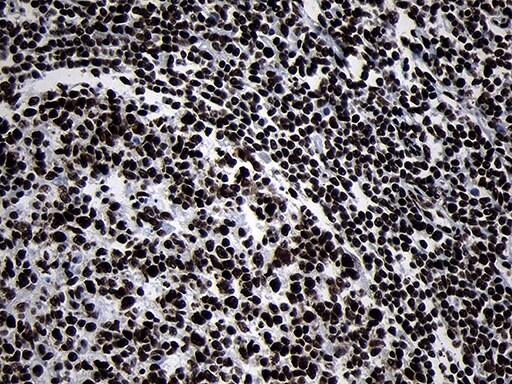 HOXC4 Antibody (OTI2D5) Immunohistochemistry;HOXC4 Antibody (OTI2D5)[NBP3-45009]-