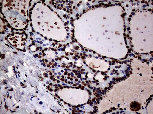 SH3BGRL Antibody (OTI8F7)