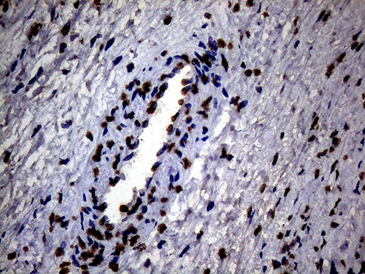 SH3BGRL Antibody (OTI8F7)
