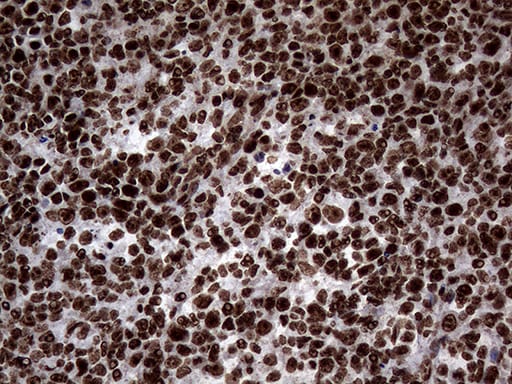 SH3BGRL Antibody (OTI8F7)